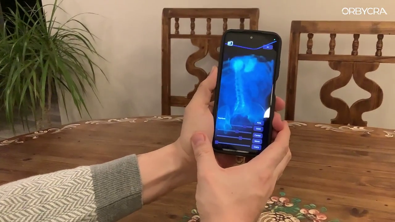 A handheld phone displaying an interactive three-dimensional volume rendering and scan controls.